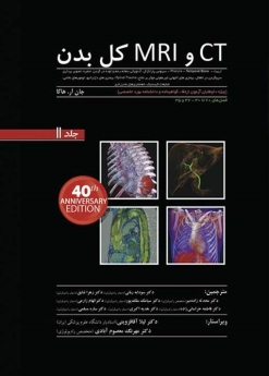 CT و MRI کل بدن ، هاگا ، جلد 2 (شومیز)