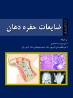 ضایعات حفره دهان 