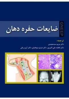 ضایعات حفره دهان 