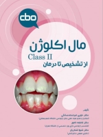 مال اکلوژن Class II؛ از تشخیص تا درمان
