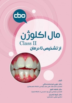 مال اکلوژن Class II؛ از تشخیص تا درمان