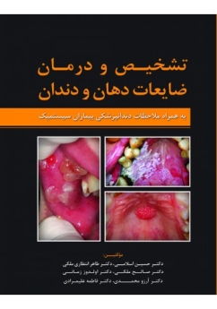 تشخیص و درمان ضایعات دهان و دندان به همراه ملاحظات دندانپزشکی بیماران سیستمیک