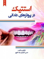 استتیک در پروتزهای دندانی