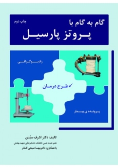 گام به گام با پروتز پارسیل