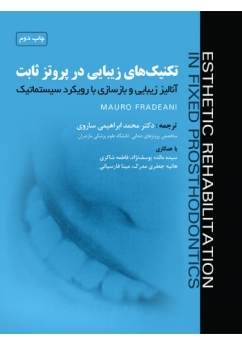 تکنیک های زیبایی در پروتز ثابت ، آنالیز زیبایی و بازسازی با رویکرد سیستماتیک