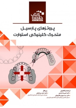 خلاصه کتاب پروتزهای پارسیل متحرک کلینیکی استوارت (Book Brief)