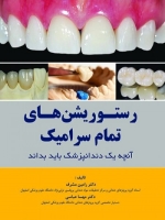 رستوریشن های تمام سرامیک آنچه یک دندانپزشک باید بداند