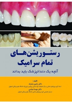 رستوریشن های تمام سرامیک آنچه یک دندانپزشک باید بداند