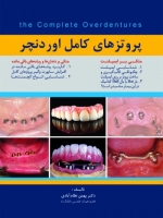 پروتزهای کامل اوردنچر