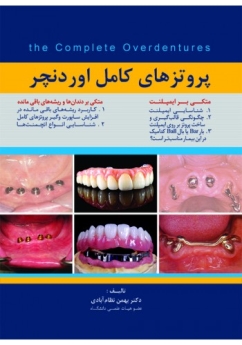پروتزهای کامل اوردنچر