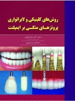 روش های کلینیکی و لابراتواری پروتز های متکی برایمپلنت