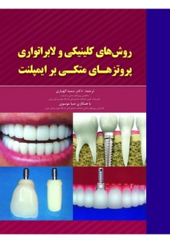 روش های کلینیکی و لابراتواری پروتز های متکی برایمپلنت