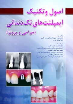 اصول وتکنیک ایمپلنت های تک دندانی (جراحی و پروتز)