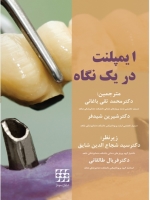 ایمپلنت در یک نگاه