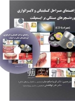راهنمای مراحل کلینیکی و لابراتواری اوردنچرهای متکی بر ایمپلنت