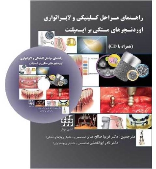 راهنمای مراحل کلینیکی و لابراتواری اوردنچرهای متکی بر ایمپلنت