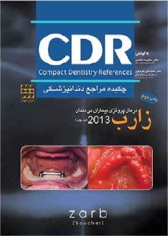  CDR چکیده مراجع دندانپزشکی ، درمان پروتزی بیماران بی دندان زارب 2013 (بوچر)