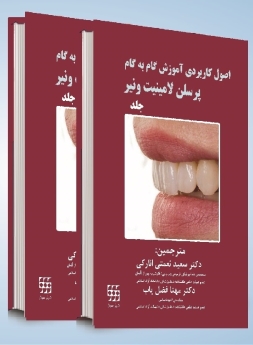 اصول کاربردی آموزش گام به گام پرسلن لامینیت ونیر