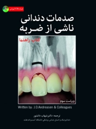 صدمات دندانی ناشی از ضربه ، همراه با CD 