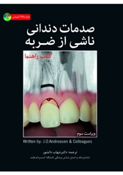 صدمات دندانی ناشی از ضربه ، همراه با CD 