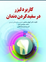 کاربرد لیزر در سفید کردن دندان