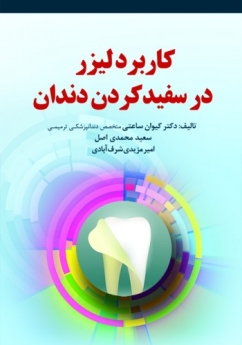 کاربرد لیزر در سفید کردن دندان