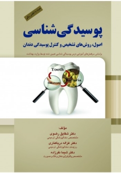 پوسیدگی شناسی ، اصول ، روش های تشخیص و کنترل پوسیدگی دندان 