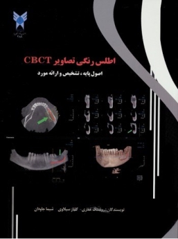 اطلس رنگی تصاویر CBCT ، اصول پایه ،تشخیص و ارائه مورد 