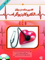 تفسیر ساده و روان الکتروکاردیوگرام