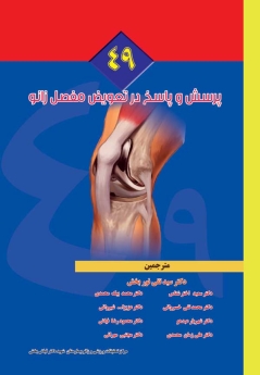 49 پرسش و پاسخ در تعویض مفصل زانو