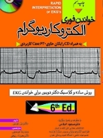 خواندن فوری الکتروکاردیوگرام