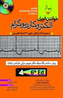 خواندن فوری الکتروکاردیوگرام