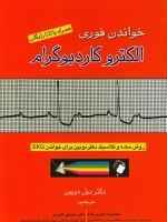 خواندن فوری الکتروکاردیوگرام : روش ساده و کلاسیک دکتر دوبین برای خواندن EKG