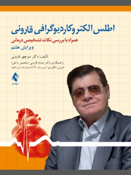 اطلس الکتروکاردیوگرافی قارونی