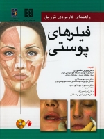 راهنمای کاربردی تزریق فیلرهای پوستی