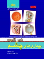  abc medicine آسان آموز دانش پزشکی ، درس آزمون بیماری های چشم