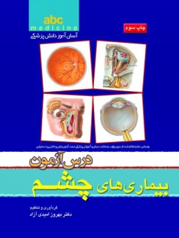  abc medicine آسان آموز دانش پزشکی ، درس آزمون بیماری های چشم