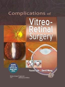 Complications of Vitreo-Retinal Surgery