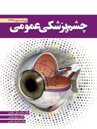چشم پزشکی عمومی