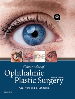 Colour Atlas of Ophthalmic Plastic Surgery, 2018 + video file