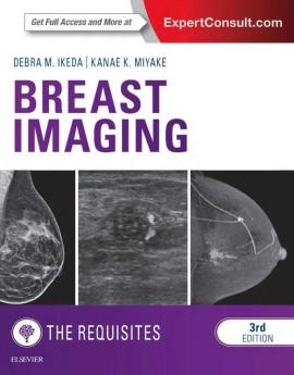 Breast Imaging : The Requisites, 2017