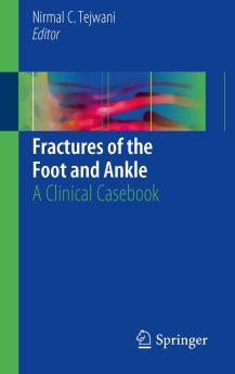 Fractures of the Foot and Ankle, 2018