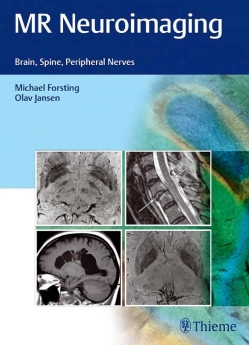 MR Neuroimaging, 2017