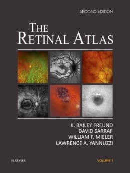 The Retinal Atlas, 2017 (2-volume)