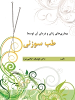 بیماریهای زنان و درمان آن توسط طب سوزنی