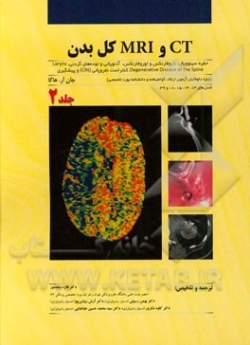 CT و MRI کل بدن: حفره سینوویال، نازوفارنکس و اوروفارنکس، آدنوپاتی و توده‌های گردنی، ... (جلد دوم)