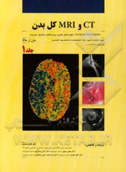 CT و MRI کل بدن: incranial neoplasms، عفونت‌های مغزی، پروسه‌های مننژیال، اوربیت ... (جلد اول)