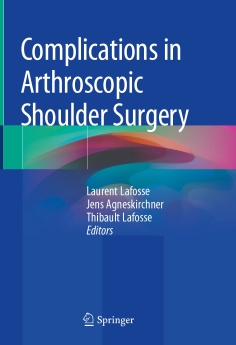 Complications in Arthroscopic Shoulder Surgery 2020