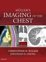 Muller's Imaging of the Chest 2nd Edition