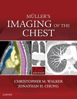Muller's Imaging of the Chest 2nd Edition